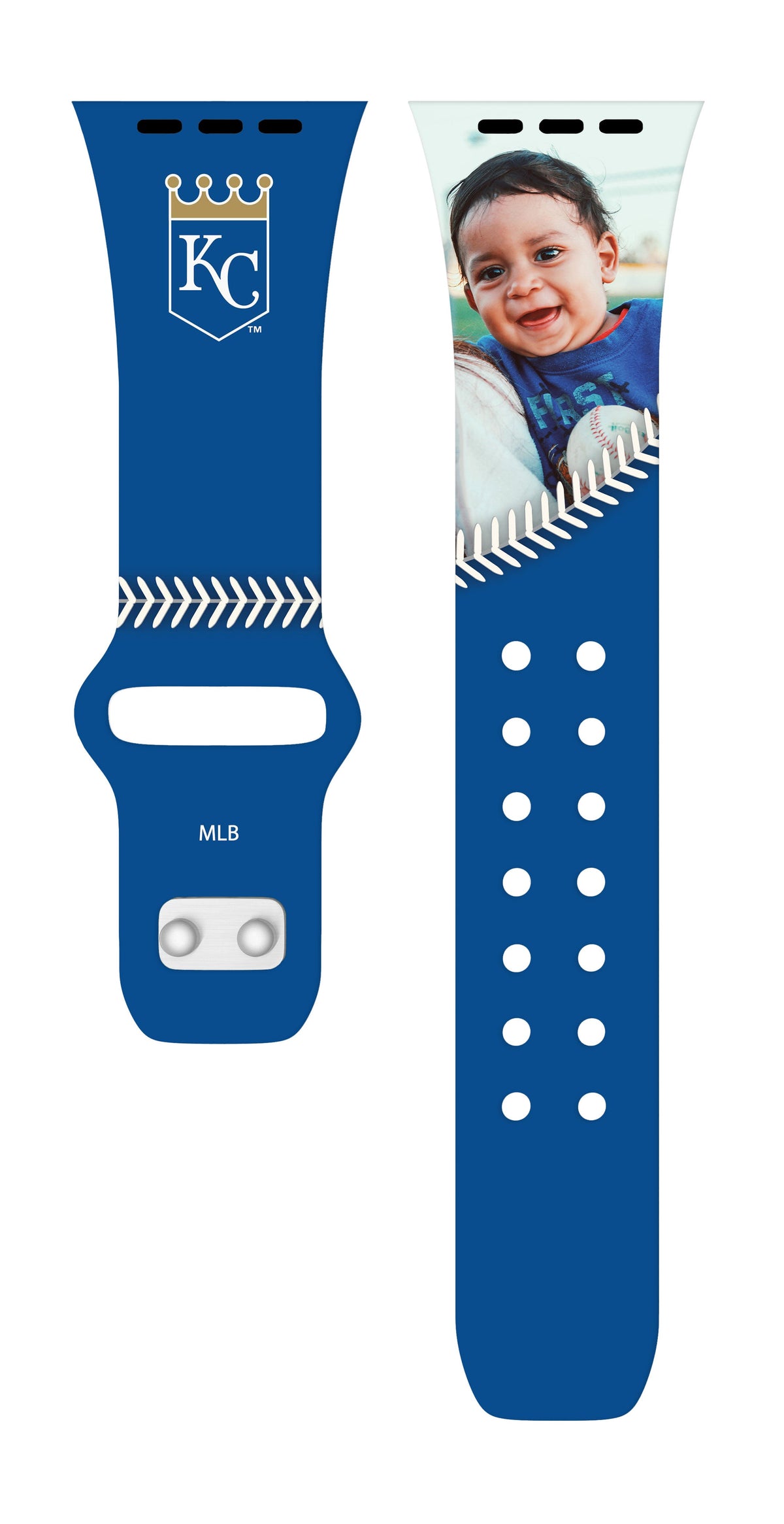 Kansas City Royals Custom Photo HD Apple Watch Band